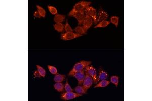 Immunofluorescence analysis of HeLa cells using SQSTM1 antibody (ABIN6290793) at dilution of 1:100. (SQSTM1 Antikörper)