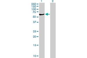 Western Blot analysis of SGSH expression in transfected 293T cell line by SGSH MaxPab polyclonal antibody. (SGSH Antikörper  (AA 1-502))
