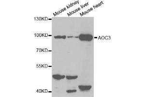 Western blot analysis of extracts of various cell lines, using AOC3 antibody. (AOC3 Antikörper  (AA 27-190))