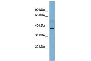 WB Suggested Anti-MARCH8 Antibody Titration:  0. (MARCH8 Antikörper  (N-Term))
