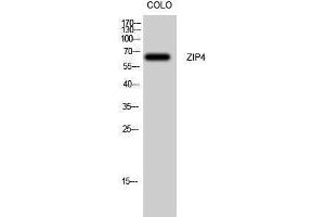 Western Blotting (WB) image for anti-Solute Carrier Family 39 (Zinc Transporter), Member 4 (SLC39A4) (Internal Region) antibody (ABIN6283913)