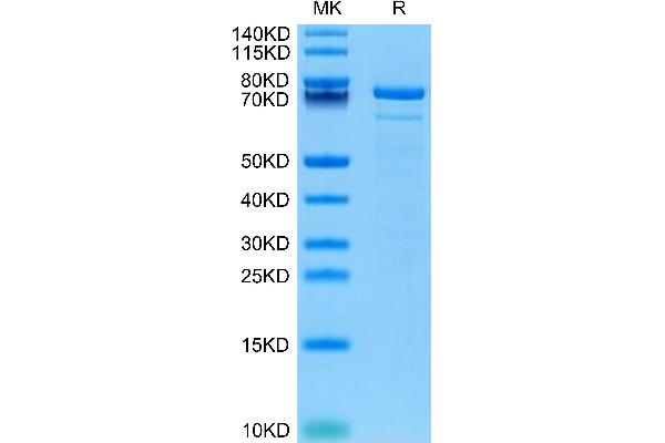 Transglutaminase 2 Protein (AA 2-687) (His tag)