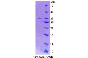 SDS-PAGE (SDS) image for Lactase (LCT) (AA 33-291) protein (His tag) (ABIN6237592) (LCT Protein (AA 33-291) (His tag))
