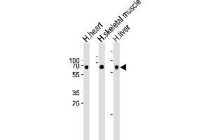 Western blot analysis of lysates from human heart, skeletal muscle and liver tissue lysate (from left to right), using Cry2 Antibody A. (CRY2 Antikörper  (C-Term))