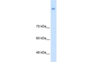 Western Blotting (WB) image for anti-Neuronal Cell Adhesion Molecule (NRCAM) antibody (ABIN2463989) (NrCAM Antikörper)