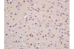 Formalin-fixed and paraffin embedded rat brain labeled with Rabbit Anti-SOD1 Polyclonal Antibody, Unconjugated  at 1:200 followed by conjugation to the secondary antibody and DAB staining (SOD1 Antikörper  (AA 6-100))