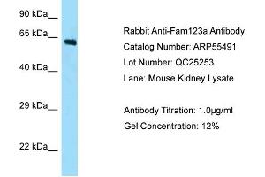 Western Blotting (WB) image for anti-APC Membrane Recruitment Protein 2 (AMER2) (N-Term) antibody (ABIN2786237) (AMER2 Antikörper  (N-Term))