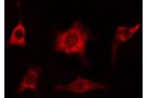 ABIN6274993 staining HeLa cells by IF/ICC. (CEP78 Antikörper  (Internal Region))