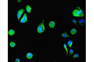 Immunofluorescent analysis of MCF-7 cells using ABIN7150796 at dilution of 1:100 and Alexa Fluor 488-congugated AffiniPure Goat Anti-Rabbit IgG(H+L) (DYRK4 Antikörper  (AA 201-520))