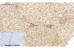 Immunohistochemical analysis of paraffin-embedded human liver tissue. (Cadherin 5 Antikörper  (Internal Region))