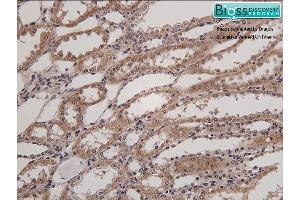 Formalin-fixed and paraffin embedded horse kidney labeled with Anti- HSD11B2 Polyclonal Antibody, Unconjugated at 1:200 followed by conjugation to the secondary antibody and DAB staining