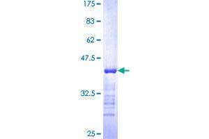 SYNE2 Protein (AA 6702-6799) (GST tag)