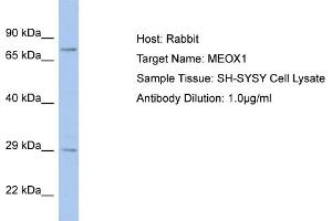 Host: Rabbit Target Name: MEOX1 Sample Tissue: Human SH-SYSY Whole Cell  Antibody Dilution: 1ug/ml (MEOX1 Antikörper  (C-Term))