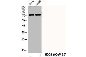 Western Blot analysis of HELA HepG2 cells using Phospho-Cortactin (Y466) Polyclonal Antibody (Cortactin Antikörper  (pTyr466))