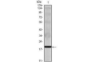 Western Blot showing IL16 antibody used against IL16 recombinant protein. (IL16 Antikörper)