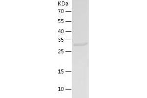 Western Blotting (WB) image for Sulfotransferase Family 1B Member 1 (SULT1B1) (AA 1-296) protein (His tag) (ABIN7125228) (SULT1B1 Protein (AA 1-296) (His tag))
