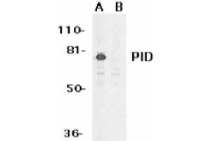 Image no. 1 for anti-Metastasis Associated 1 Family, Member 2 (MTA2) (AA 652-668) antibody (ABIN265128) (MTA2 Antikörper  (AA 652-668))