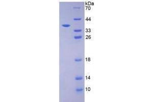Image no. 1 for Insulin (INS) (AA 25-54) (Active) protein (His tag,GST tag) (ABIN6239875)