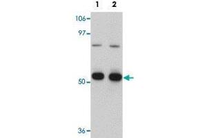 Western blot analysis of K-562 cells with CDC23 polyclonal antibody  at (Lane 1) 1 and (Lane 2) 2 ug/mL dilution. (CDC23 Antikörper  (Internal Region))