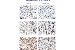 Image no. 3 for anti-F-Box Protein 11 (FBXO11) (Internal Region) antibody (ABIN559708)