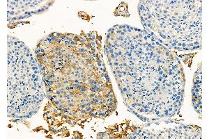 ABIN6262982 and ABIN6273264 at 1/100 staining Mouse testis tissue by IHC-P.