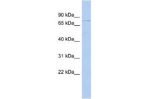 DHX58 antibody used at 1 ug/ml to detect target protein. (DHX58 Antikörper)