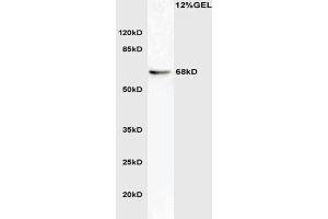 L1 mouse brain lysate probed with Anti phospho-ATG16A(Ser287) Polyclonal Antibody, Unconjugated  at 1:3000 for 90 min at 37˚C. (ATG16L1 Antikörper  (pSer287))