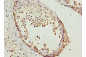 Immunohistochemistry of paraffin-embedded human testis tissue using ABIN7150790 at dilution of 1:100 (TESK2 Antikörper  (AA 302-571))