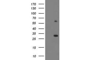 Western Blotting (WB) image for anti-Potassium Channel Tetramerisation Domain Containing 14 (KCTD14) antibody (ABIN1499009) (KCTD14 Antikörper)