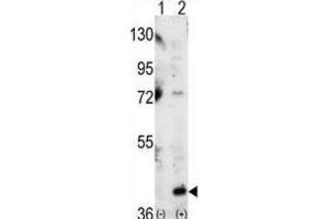 Western Blotting (WB) image for anti-Mitogen-Activated Protein Kinase 14 (MAPK14) antibody (ABIN3003280)