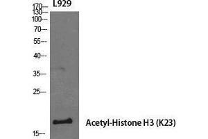 Western Blot (WB) analysis of specific cells using Acetyl-Histone H3 (K23) Polyclonal Antibody.