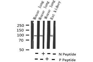 Western blot analysis of Phospho-STAT6 (Thr645) expression in various lysates (STAT6 Antikörper  (pThr645))