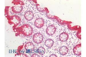 ABIN5539706 (5µg/ml) staining of paraffin embedded Human Colon. (KRT20 Antikörper  (Internal Region))