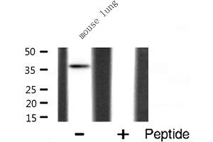 Western blot analysis of hnRNP A2/B1 expression in Mouse lung lysate (HNRNPA2B1 Antikörper  (N-Term))