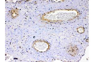 Immunohistochemistry (IHC) image for anti-VEGF Receptor 2 (VEGFR2) (AA 20-242) antibody (ABIN5519021)