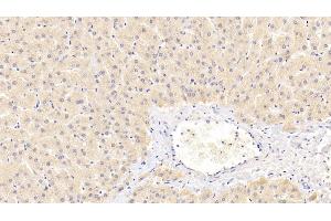 Detection of PEX2 in Human Liver Tissue using Polyclonal Antibody to Peroxisomal Biogenesis Factor 2 (PEX2) (PEX2 Antikörper  (AA 233-305))