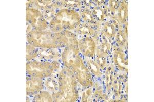 Immunohistochemistry of paraffin-embedded mouse kidney using XIAP antibody (ABIN5974139) at dilution of 1/100 (40x lens). (XIAP Antikörper)