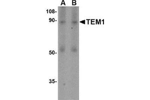 Western blot analysis of TEM1 in human colon tissue lysate with this product at (A) 0. (CD248 Antikörper  (N-Term))