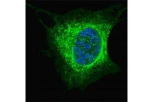 Fluorescent confocal image of SY5Y cells stained with Vimentin antibody at 1:200. (Vimentin Antikörper  (AA 63-90))