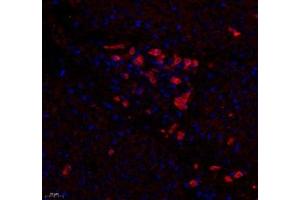 Immunofluorescence of paraffin embedded human colon cancer using DCR3 (ABIN7076071) at dilution of 1: 700 (400x lens) (TNFRSF6B Antikörper)
