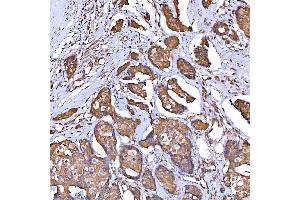 IHC analysis of TOMM34 using anti-TOMM34 antibody (ABIN7599253). (TOMM34 Antikörper  (AA 1-309))