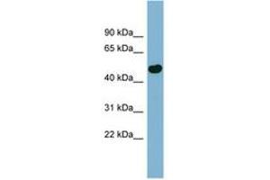 Image no. 1 for anti-EF-Hand Calcium Binding Domain 4B (EFCAB4B) (AA 71-120) antibody (ABIN6741790) (EFCAB4B Antikörper  (AA 71-120))
