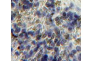 Used in DAB staining on fromalin fixed paraffin-embedded Spleen tissue (HPSE Antikörper  (AA 34-115))