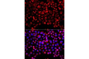 Immunofluorescence analysis of  cells using SULT1E1 antibody (ABIN6129758, ABIN6148714, ABIN6148715 and ABIN6223332). (SULT1E1 Antikörper  (AA 140-294))