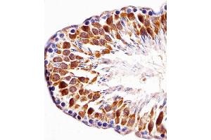 Immunohistochemistry (Paraffin-embedded Sections) (IHC (p)) image for anti-PDZ Binding Kinase (PBK) (AA 58-86), (N-Term) antibody (ABIN1881635)