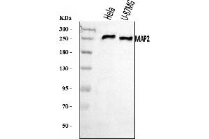 Western blot analysis of MAP2 using anti-MAP2 antibody (ABIN7601483). (MAP2 Antikörper  (AA 360-1101))