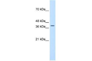 WB Suggested Anti-TFB2M Antibody Titration:  1. (TFB2M Antikörper  (N-Term))