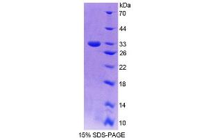 SDS-PAGE analysis of Human GBP6 Protein.