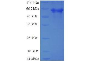 AHA1, Activator of Heat Shock 90kDa Protein ATPase Homolog 1 (Yeast) (AHSA1) (AA 1-338), (full length) protein (GST tag)