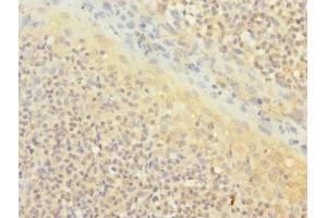 Immunohistochemistry of paraffin-embedded human tonsil tissue using ABIN7171372 at dilution of 1:100 (CD1c Antikörper  (AA 18-300))